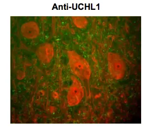 IHC-Fr analysis of rat spinal cord tissue using GTX82568 PGP9.5 antibody [BH7]. Red: primary antibody Green: anti-neurofilament NF-H antibody