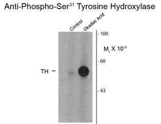Western blot of PC-12 cells incubated in the absence (Control) and presence of okadaic acid (OA, 1 microM for 60 min) showing specific immunolabeling of the ~60k TH phosphorylated at Ser31 using TH (phospho Ser31) antibody (GTX82569). Western blot of PC-12 cells incubated in the absence (Control) and presence of okadaic acid (OA, 1 microM for 60 min) showing specific immunolabeling of the ~60k TH phosphorylated at Ser31 using TH (phospho Ser31) antibody (GTX82569).