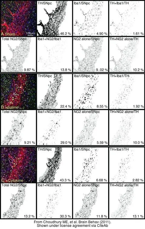The data was published in the journal Brain Behav in 2011. PMID: 22398979 The data was published in the journal Brain Behav in 2011. PMID: 22398979