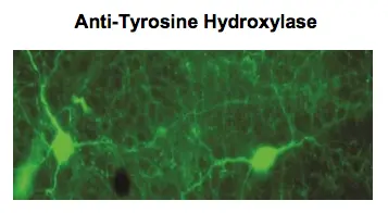 Immunostaining of rabbit retina showing specific labeling of tyrosine hydroxylase in green using TH antibody (GTX82570).