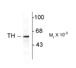 Western blot of 10 ug of rat caudate lysate showing specific immunolabeling of the ~ 60 k tyrosine hydroxylase proteins using TH antibody (GTX82570).