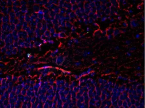 Immunostaining of mouse dentate gyrus showing beta III tubulin in red and nuclei in blue. Immunostaining of mouse dentate gyrus showing beta III tubulin in red and nuclei in blue.