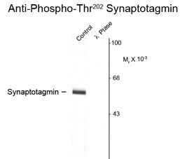 Western blot of rat cortex lysate showing specific immunolabeling of the ~62k synaptotagmin phosphorylated at Thr202 (Control). Phosphospecificity is shown in the second lane (lambda-phosphatase: lambda-Ptase).