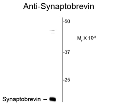 Western blot of rat brain lysate showing specific immunolabeling of the ~ 16k synaptobrevin protein using Synaptobrevin (VAMP) antibody [SP10] (GTX82588).