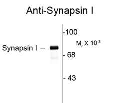 Western blot of rat hippocampal (Hipp) lysate showing specific immunolabeling of the ~78k synapsin I doublet protein using Synapsin I antibody (GTX82593) Western blot of rat hippocampal (Hipp) lysate showing specific immunolabeling of the ~78k synapsin I doublet protein using Synapsin I antibody (GTX82593)