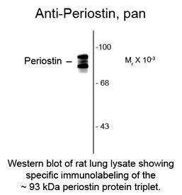Periostin antibody Periostin antibody