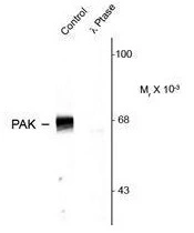 WB analysis of rat hippocampal tissue lysate using GTX82619 PAK1 ( phospho Thr423 ) / PAK2 ( phospho Thr402 ) / PAK3 ( phospho Thr436 ) antibody. Lane 1 : primary antibody Lane 2 : treatment with lambda phosphatase (lambda-Ptase, 1200 units for 30 minutes). WB analysis of rat hippocampal tissue lysate using GTX82619 PAK1 ( phospho Thr423 ) / PAK2 ( phospho Thr402 ) / PAK3 ( phospho Thr436 ) antibody. Lane 1 : primary antibody Lane 2 : treatment with lambda phosphatase (lambda-Ptase, 1200 units for 30 minutes).