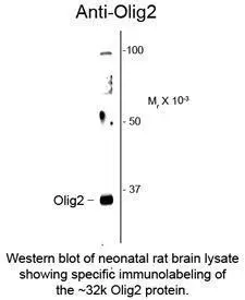 OLIG2 antibody OLIG2 antibody