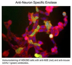 NSE antibody NSE antibody