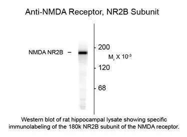 NMDAR2B antibody NMDAR2B antibody