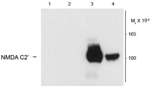 Western blot of HEK293 cells using GTX82638 expressing: 1. without NR1 expression 2. NR1 subunit containing only the C2 insert 3,4. NR1 subunit containing the C1/C2 and N1/C2 insert Western blot of HEK293 cells using GTX82638 expressing: 1. without NR1 expression 2. NR1 subunit containing only the C2 insert 3,4. NR1 subunit containing the C1/C2 and N1/C2 insert