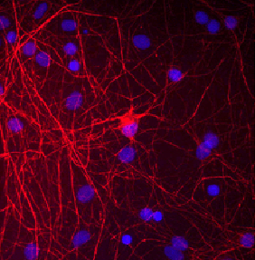 Immunostaining of cultured neurons and glia with anti chicken neurofilament M antibody (red) using GTX82642 Immunostaining of cultured neurons and glia with anti chicken neurofilament M antibody (red) using GTX82642