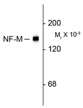 Western blot of rat cortex lysate showing specific immunolabeling of the ~145k NF-M protein using GTX82643 Western blot of rat cortex lysate showing specific immunolabeling of the ~145k NF-M protein using GTX82643