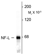 Western blot of rat cortex lysate showing specific immunolabeling of the ~68kD NF-L protein using GTX82644 Western blot of rat cortex lysate showing specific immunolabeling of the ~68kD NF-L protein using GTX82644