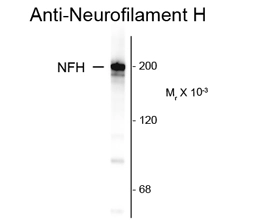 Western blot of rat cortex lysate showing specific immunolabeling of the ~200k NF-H protein using Neurofilament NF-H antibody [NAP4] (GTX82647).