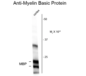 Western blot of rat cortex homogenate showing specific immunolabeling of the ~18 and 22k MBP protein using MBP antibody (GTX82648). Western blot of rat cortex homogenate showing specific immunolabeling of the ~18 and 22k MBP protein using MBP antibody (GTX82648).