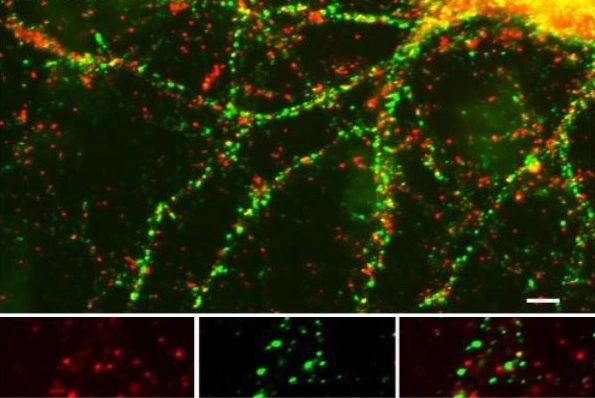 ICC/IF analysis of 14 DIV rat cortical neurons using Munc-18 (phospho Ser 513) antibody (red) and PSD95 (green). ICC/IF analysis of 14 DIV rat cortical neurons using Munc-18 (phospho Ser 513) antibody (red) and PSD95 (green).