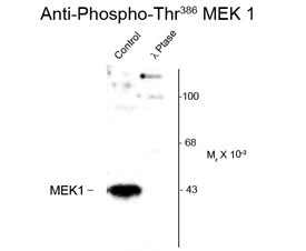 Western blot of human T47D cells showing phospho-specific immunolabeling of the ~45k MEK1 protein phosphorylated at Thr 386 using MEK1 (phospho Thr386) antibody (GTX82656). Western blot of human T47D cells showing phospho-specific immunolabeling of the ~45k MEK1 protein phosphorylated at Thr 386 using MEK1 (phospho Thr386) antibody (GTX82656).