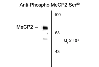 Western blot of neonatal rat brain showing specific immunolabeling of the ~75k MeCP2 protein phosphorylated at Ser 80 using MeCP2 (phospho Ser80) antibody (GTX82658). Western blot of neonatal rat brain showing specific immunolabeling of the ~75k MeCP2 protein phosphorylated at Ser 80 using MeCP2 (phospho Ser80) antibody (GTX82658).