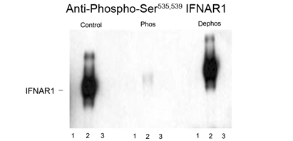 Western blot of immunoprecipitates from HEK 293 cells transfected with 1. Mock 2. IFNAR1 WT and 3. IFNAR1 Ser 535 Arg and Ser 539 Arg mutants. The immunolabeling is absent in the IFNAR1 Ser 535 and Ser 539 mutants. The labeling is blocked by the phosphopeptide (Phos) used as the antigen but not by the dephosphopeptide (Dephos). Western blot of immunoprecipitates from HEK 293 cells transfected with 1. Mock 2. IFNAR1 WT and 3. IFNAR1 Ser 535 Arg and Ser 539 Arg mutants. The immunolabeling is absent in the IFNAR1 Ser 535 and Ser 539 mutants. The labeling is blocked by the phosphopeptide (Phos) used as the antigen but not by the dephosphopeptide (Dephos).