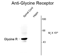 Western blot of rat spinal cord and hippocampal lysates showing specific immunolabeling of the ~48k glycine receptor in spinal cord using Glycine Receptor antibody (GTX82665). Western blot of rat spinal cord and hippocampal lysates showing specific immunolabeling of the ~48k glycine receptor in spinal cord using Glycine Receptor antibody (GTX82665).