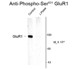 Western blot of rat hippocampal lysate showing phospho-specific immunolabeling of the ~100k GluR1 protein phosphorylated at Ser 831 using GluR1-subunit (phospho Ser831) antibody (GTX82669). Western blot of rat hippocampal lysate showing phospho-specific immunolabeling of the ~100k GluR1 protein phosphorylated at Ser 831 using GluR1-subunit (phospho Ser831) antibody (GTX82669).