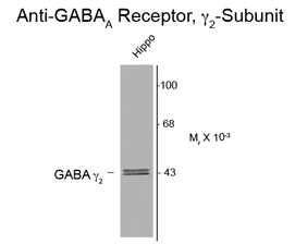 Western blot of 10 ug of rate hippocampal lysate showing specific immunolabeling of the ~46k gamma 2-subunit of the GABAA-R using GABAA Receptor gamma 2 antibody (GTX82677). Western blot of 10 ug of rate hippocampal lysate showing specific immunolabeling of the ~46k gamma 2-subunit of the GABAA-R using GABAA Receptor gamma 2 antibody (GTX82677).
