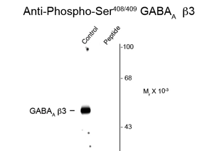 Western blot of rat hippocampal lysate showing specific immunolabeling of the ~53k GABAA beta 3 protein phosphorylated at Ser 408/409 (control) using GABAA Receptor, beta 3 (phospho Ser408/409) antibody (GTX82680). Immunolabeling is blocked by the phospho-peptide (peptide) used as antigen. Western blot of rat hippocampal lysate showing specific immunolabeling of the ~53k GABAA beta 3 protein phosphorylated at Ser 408/409 (control) using GABAA Receptor, beta 3 (phospho Ser408/409) antibody (GTX82680). Immunolabeling is blocked by the phospho-peptide (peptide) used as antigen.