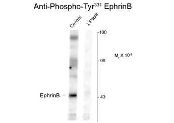 Western blot of rat testes lysate showing phospho-specific immunolabeling of the ~46k EphrinB protein phosphorylated at Tyr 344 using Ephrin B1 (phospho Tyr344) antibodyy (GTX82698). Western blot of rat testes lysate showing phospho-specific immunolabeling of the ~46k EphrinB protein phosphorylated at Tyr 344 using Ephrin B1 (phospho Tyr344) antibodyy (GTX82698).