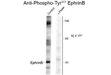 Western blot of rat testes lysate showing phospho-specific immunolabeling of the ~46k Ephrin B protein phosphorylated at Tyr 317 using Ephrin B1 (phospho Tyr329) antibody (GTX82699). Western blot of rat testes lysate showing phospho-specific immunolabeling of the ~46k Ephrin B protein phosphorylated at Tyr 317 using Ephrin B1 (phospho Tyr329) antibody (GTX82699).