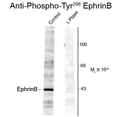 Western blot of rat testes lysate showing phospho-specific immunolabeling of the ~46k EphrinB protein phosphorylated at Tyr 298 using Ephrin B1 (phospho Tyr317) antibody (GTX82700). Western blot of rat testes lysate showing phospho-specific immunolabeling of the ~46k EphrinB protein phosphorylated at Tyr 298 using Ephrin B1 (phospho Tyr317) antibody (GTX82700).