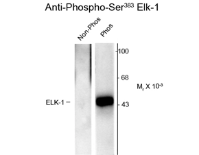 Western blot of non-phospho- and phospho-recombinant Elk-1 showing specific immunolabeling of the ~46 Elk-1 protein phosphorylated at Ser 383 using Elk-1 (phospho Ser383) antibody (GTX82701). Western blot of non-phospho- and phospho-recombinant Elk-1 showing specific immunolabeling of the ~46 Elk-1 protein phosphorylated at Ser 383 using Elk-1 (phospho Ser383) antibody (GTX82701).