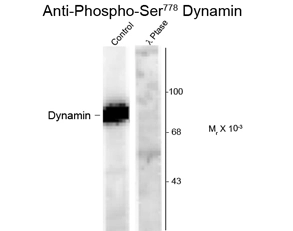Western blot of forskolin stimulated rat hippocampal lysate showing phospho-specific immunolabeling of the ~95k Dynamin protein phosphorylated at Ser 778 using Dynamin (phospho Ser778) antibody (GTX82702). Western blot of forskolin stimulated rat hippocampal lysate showing phospho-specific immunolabeling of the ~95k Dynamin protein phosphorylated at Ser 778 using Dynamin (phospho Ser778) antibody (GTX82702).