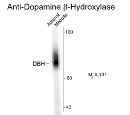 Western blot of 20 ug of human adrenal medulla lysate showing specific immunolabeling of the ~75k DBH protein using Dopamine @-Hydroxylase antibody, N-Term (GTX82707).
