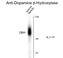 Western blot of 20 ug of human adrenal medulla lysate showing specific immunolabeling of the ~75k DBH protein using Dopamine @-Hydroxylase antibody, C-Term (GTX82708). Western blot of 20 ug of human adrenal medulla lysate showing specific immunolabeling of the ~75k DBH protein using Dopamine @-Hydroxylase antibody, C-Term (GTX82708).