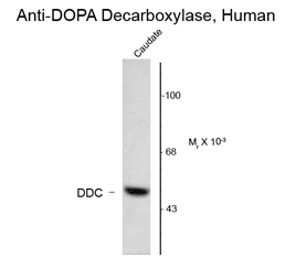 Western blot of 20 ug of human caudate lysate showing specific immunolabeling of the ~55k DOPA Decarboxylase protein using DOPA Decarboxylase antibody (GTX82709).