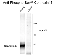 Western blot of rat hippocampal lysate showing phospho-specific immunolabeling of the ~43k Connexin 43 protein phosphorylated at Ser 368 using Connexin 43 (phospho Ser368) antibody (GTX82717). Western blot of rat hippocampal lysate showing phospho-specific immunolabeling of the ~43k Connexin 43 protein phosphorylated at Ser 368 using Connexin 43 (phospho Ser368) antibody (GTX82717).