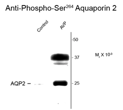 Western blot of vasopressin (AVP) treated rat kidney lysate showing specific immunolabeling of the ~29k and 37k glycosylated form of the AQP2 protein phosphorylated at Ser 264 using Aquaporin 2 (phospho Ser264) antibody (GTX82735). Western blot of vasopressin (AVP) treated rat kidney lysate showing specific immunolabeling of the ~29k and 37k glycosylated form of the AQP2 protein phosphorylated at Ser 264 using Aquaporin 2 (phospho Ser264) antibody (GTX82735).