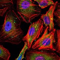 ICC/IF analysis of HeLa cells using GTX82750 Cyclin B1 antibody [5G6]. Green : Cyclin B1 Blue: DRAQ5 fluorescent DNA dye Red: Actin filaments