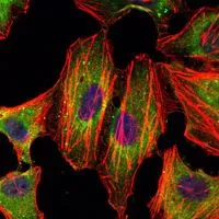 ICC/IF analysis of HeLa cells using GTX82752 STAT3 antibody [3B5]. Green : STAT3 Blue: DRAQ5 fluorescent DNA dye Red: Actin filaments