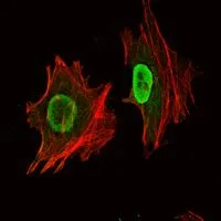 ICC/IF analysis of NTERA-2 cells using GTX82755 Oct4 antibody [7E7]. Green : Oct4 Red: Actin filaments