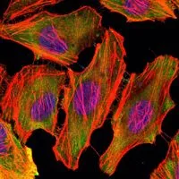 ICC/IF analysis of U251 cells using GTX82757 CSK antibody [5F3]. Green : CSK Blue: DRAQ5 fluorescent DNA dye Red: Actin filaments