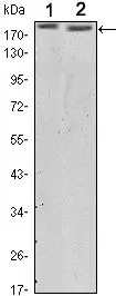 WB analysis of SKBR3 (1) and MCF-7 (2) cell lysate using GTX82764 Her2 / ErbB2 antibody [6C2].