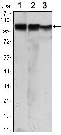 WB analysis of Jurkat (1), HeLa (2) and HEK293 (3) cell lysate using GTX82791 Hexokinase II antibody [3D3].