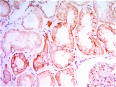 IHC-P analysis of human kidney tissue using GTX82794 PTH1R antibody [4D2].