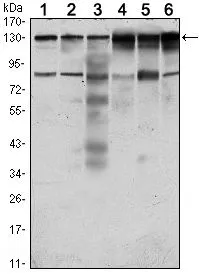 WB analysis of HeLa (1), A431 (2), HCT116 (3), Caco2 (4), HepG2 (5) and MCF-7 (6) cell lysate using GTX82801 CCK4 antibody [4F9].
