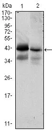 WB analysis of HTC116 (1) and T47D (2) cell lysate using GTX82831 EPCAM antibody [7E11].