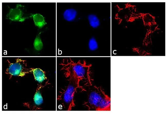 ICC/IF analysis of Neuro-2a cells using GTX82848 APS antibody. Panel e is a no primary antibody control. Green : Primary antibody Blue : Nuclei Red : Actin Fixation : 4% paraformaldehyde Permeabilization : 0.1% Triton X-100 for 10 minute Dilution : 1:250 dilution in 0.1% BSA and incubated for 3 hours at room temperature ICC/IF analysis of Neuro-2a cells using GTX82848 APS antibody. Panel e is a no primary antibody control. Green : Primary antibody Blue : Nuclei Red : Actin Fixation : 4% paraformaldehyde Permeabilization : 0.1% Triton X-100 for 10 minute Dilution : 1:250 dilution in 0.1% BSA and incubated for 3 hours at room temperature