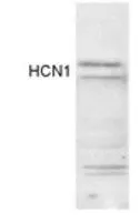WB analysis of rat brain extracts using GTX82889 HCN1 antibody. WB analysis of rat brain extracts using GTX82889 HCN1 antibody.