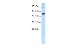 WB analysis of HepG2 cells using GTX82948 MDM4 antibody at 0.2-1microg/ml. WB analysis of HepG2 cells using GTX82948 MDM4 antibody at 0.2-1microg/ml.